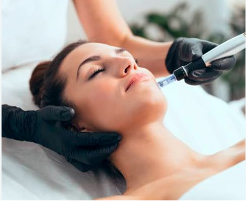 Microneedling